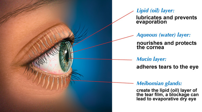 Dry Eye | Eye Conditions | Eyecare | Auckland